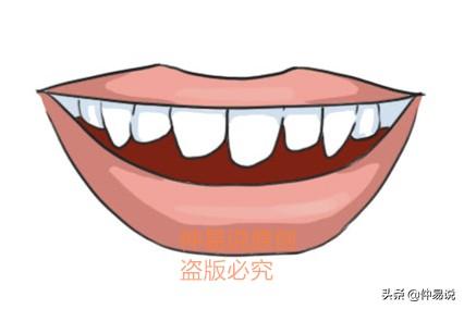 狗齿的男人脾气暴躁性格极差 图片3