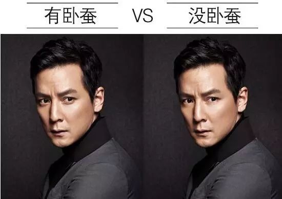 7个方面看你眼睛长的好不好 图片9