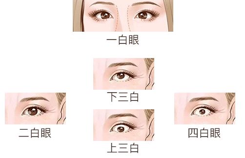 7个方面看你眼睛长的好不好 图片19