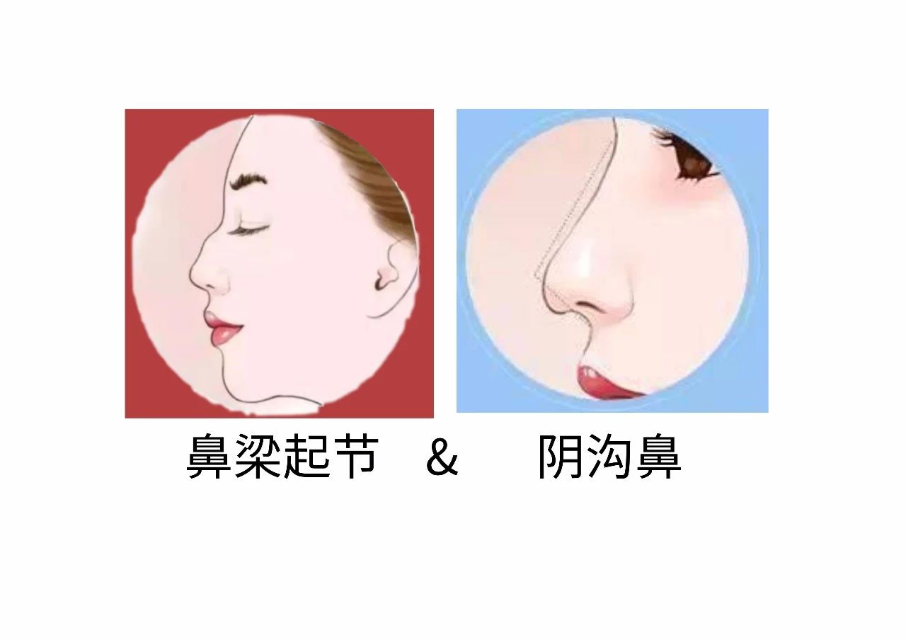 好婆婆与坏婆婆的面相特征 图片19