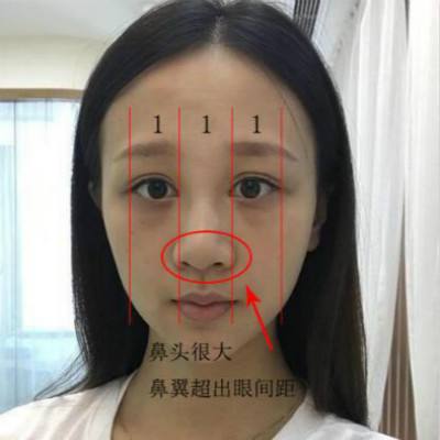 面相口诀之鼻头青现身多病 图片1