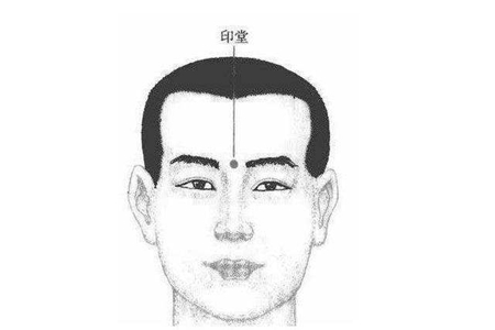 印堂有疤痕对人会有什么影响 它会带来厄运吗 图片3
