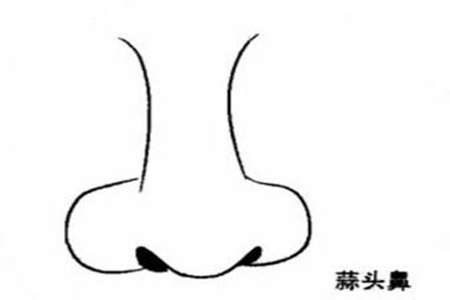 蒜头朝天鼻运势 她们具有什么样的命运 图片1