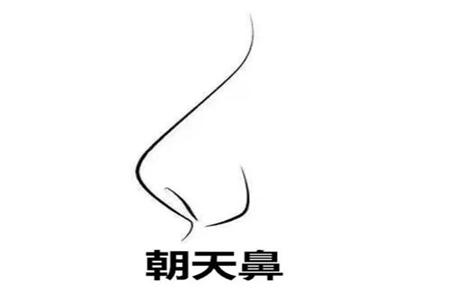 蒜头朝天鼻运势 她们具有什么样的命运 图片3