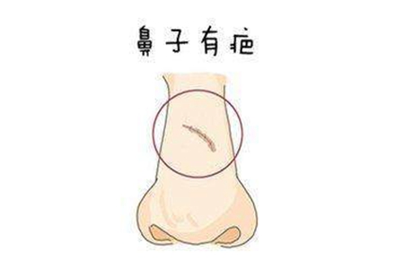 脸上有疤痕运势 脸上有疤痕会带给我们坏运吗 图片2 脸上有疤痕运势 脸上有疤痕会带给我们坏运吗 图片1