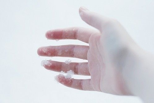 身体健康自查，这几种手相的人身体状态不佳，需要注意保养！ 图片1