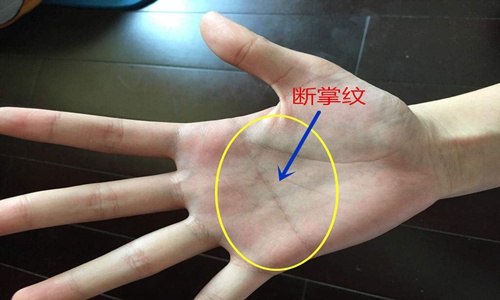 婴儿断掌纹好不好,男士断掌纹好不好 图片4 婴儿断掌纹好不好,男士断掌纹好不好 图片3
