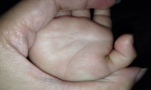 婴儿断掌纹好不好,男士断掌纹好不好 图片6 婴儿断掌纹好不好,男士断掌纹好不好 图片5