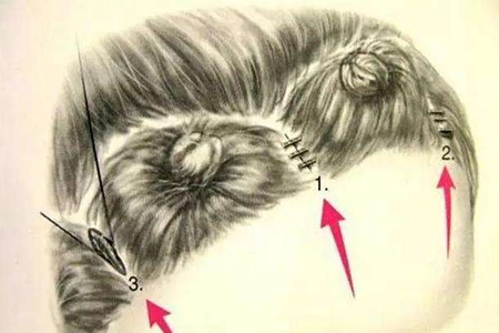 M型发际线运势 不同发际线代表不同的命运 图片5