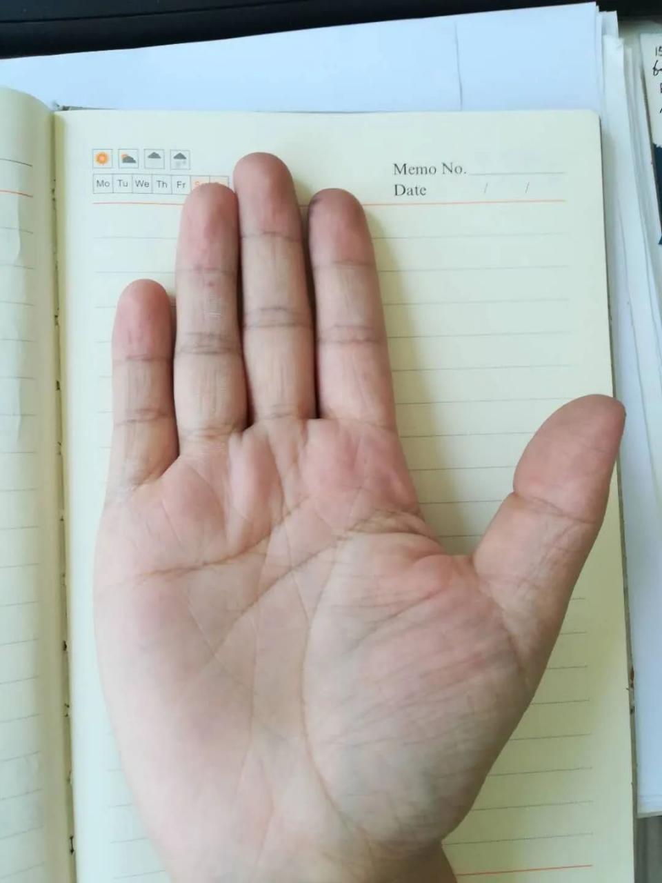 手诊分析：大鱼际青筋暴露的原因 图片3
