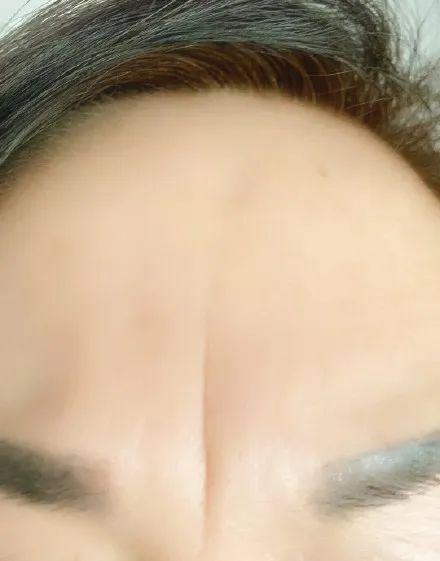 手相面相上常见的纹路和痣的解答 图片5