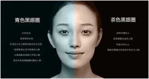 教你由内而外养护你的眼睛 图片15