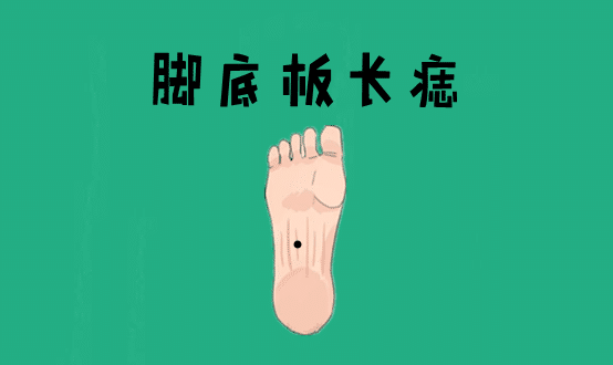 身体有这5颗巨富痣，不是高官就是大老板 图片1