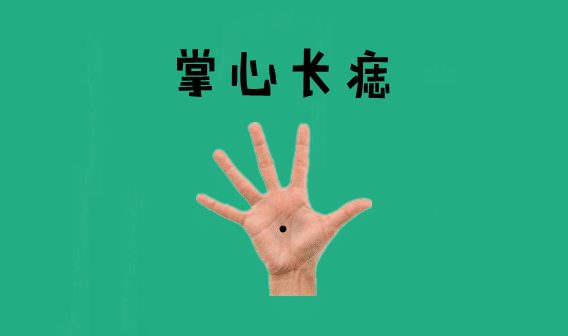 身体有这5颗巨富痣，不是高官就是大老板 图片3