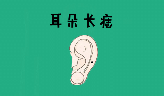 身体有这5颗巨富痣，不是高官就是大老板 图片7