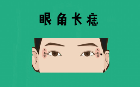 身体有这5颗巨富痣，不是高官就是大老板