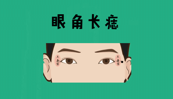 身体有这5颗巨富痣，不是高官就是大老板 图片9