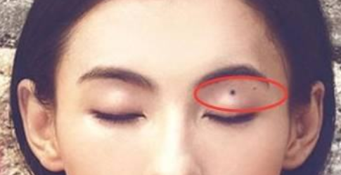 女孩子眼皮上长痣和断掌的女人是不是命不好 图片1