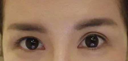 女孩子眼皮上长痣和断掌的女人是不是命不好 图片7