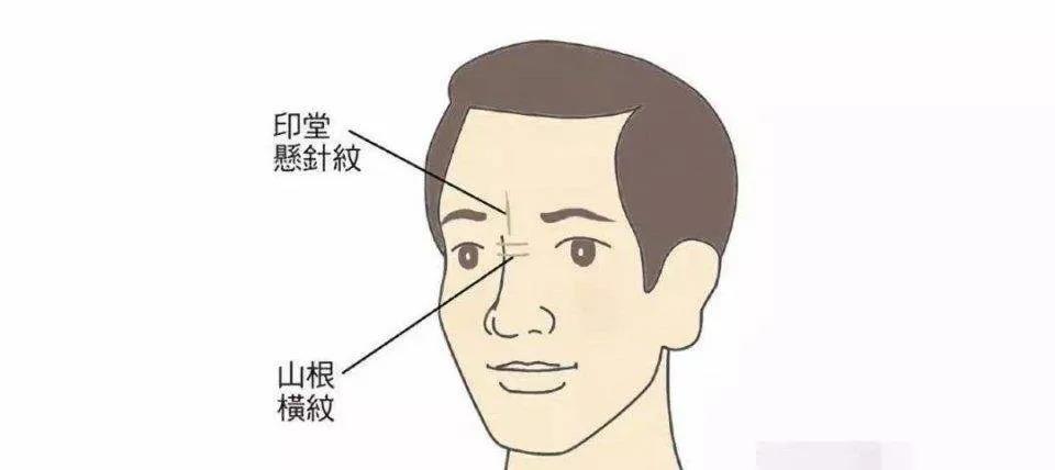 解读面相上的阴骘纹即阴德纹 图片2 解读面相上的阴骘纹即阴德纹 图片1