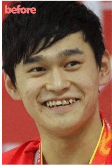 肖战和孙杨为何如此倒霉？面相和姓名早已揭露 图片13