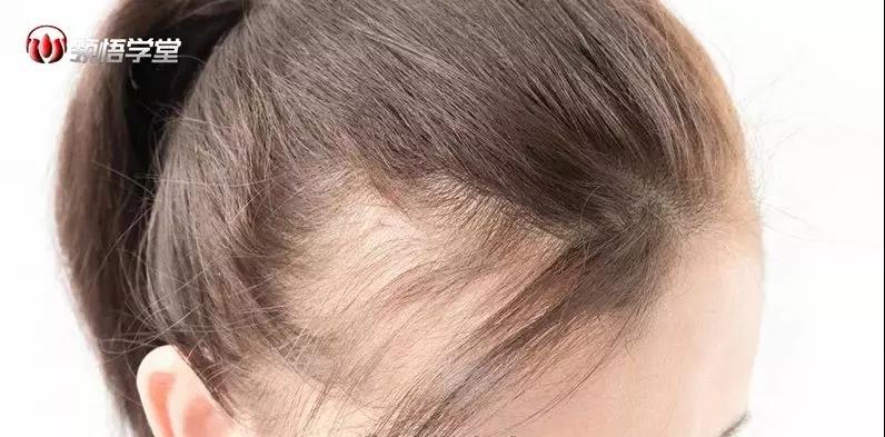 面相决定了你的婚姻，这些面相注定离婚 图片1