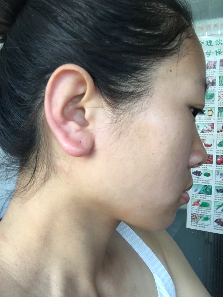 耳朵什么时间痒预示着你的运势吉凶 图片1