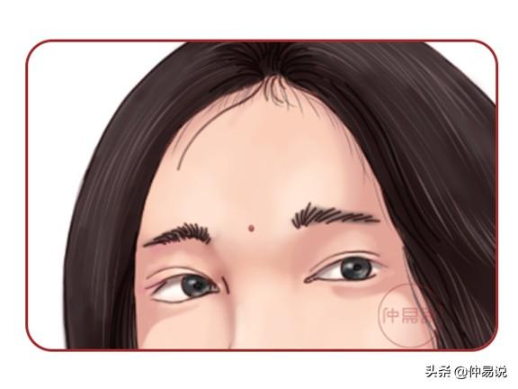 女人脸上两种美人痣，好命又旺夫的美人痣 图片3