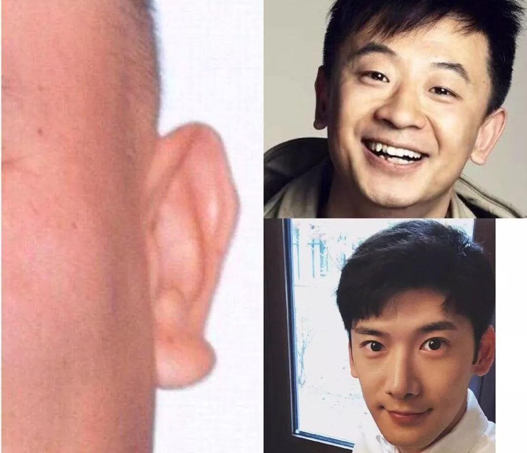 关于耳垂的面相知识 图片1