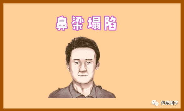 穷酸相的特征，面相解读穷酸命的面相特征 图片7
