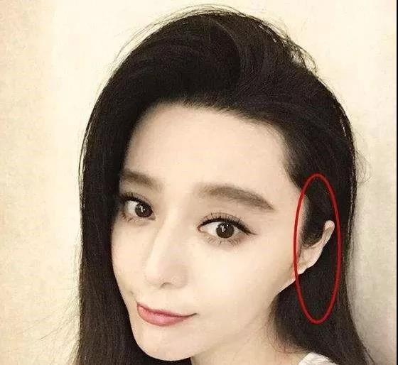 耳朵对运势的影响、图解鸡嘴耳和招风耳 图片3