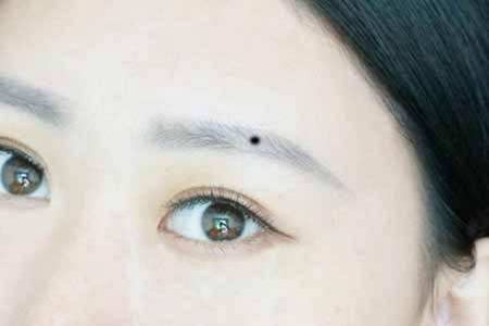 女人十处有痣是富贵痣 不可轻易点掉 图片3
