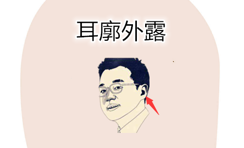 穷人的面相特征，只要占一样，日子紧巴巴 图片1