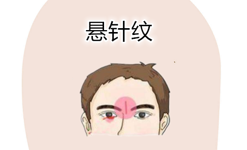 穷人的面相特征，只要占一样，日子紧巴巴 图片3
