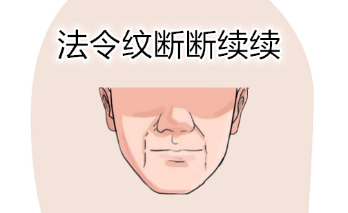 穷人的面相特征，只要占一样，日子紧巴巴 图片7