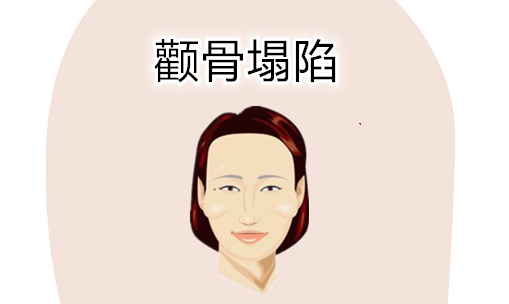 穷人的面相特征，只要占一样，日子紧巴巴 图片9