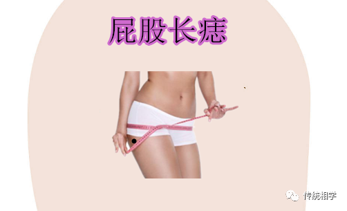 身体有这几个颗暴富痣，万里挑一的好命 图片1