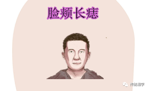 身体有这几个颗暴富痣，万里挑一的好命 图片5