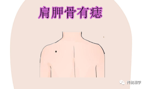 身体有这几个颗暴富痣，万里挑一的好命