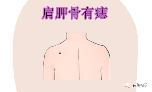 身体有这几个颗暴富痣，万里挑一的好命 图片7