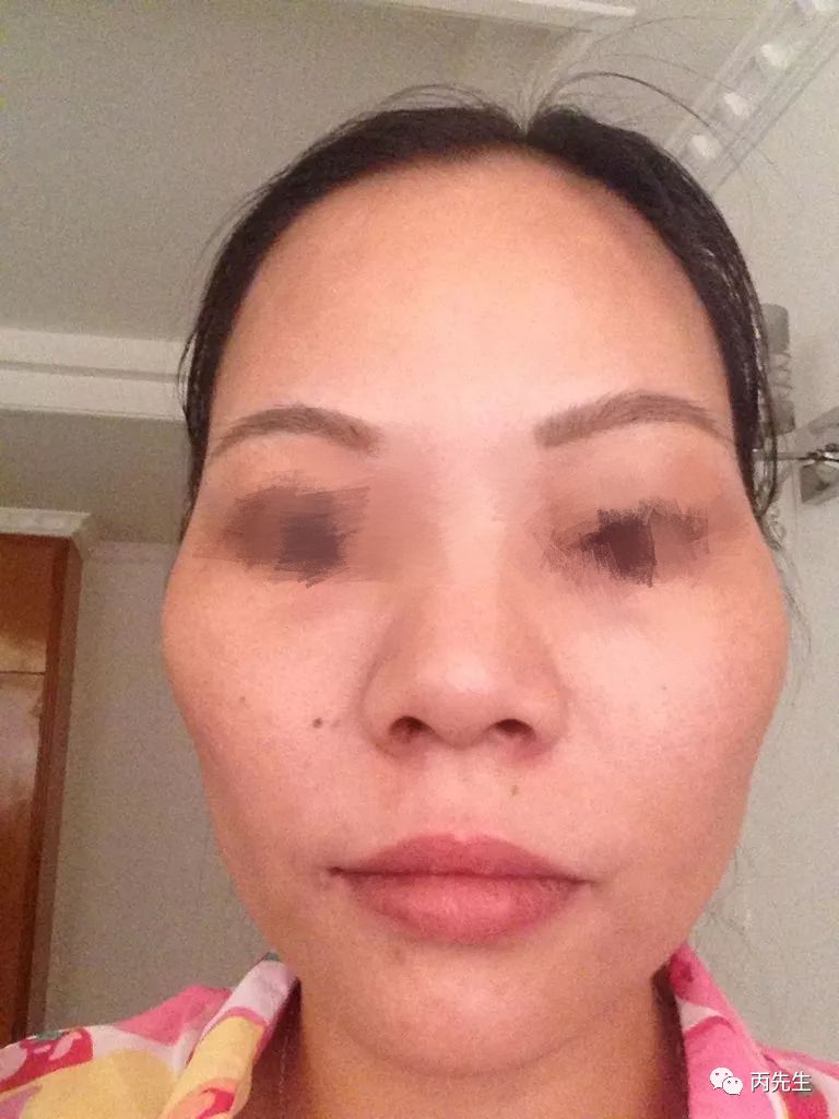 女人颧骨高杀夫不用刀，颧骨高的女人克夫是真的吗？ 图片23