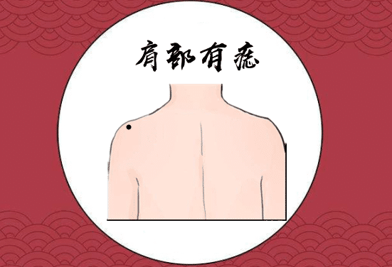 身体有这些富贵痣,腰缠万贯百里挑一的贵人命 图片2 身体有这些富贵痣,腰缠万贯百里挑一的贵人命 图片1