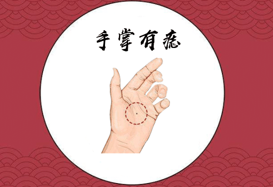 身体有这些富贵痣,腰缠万贯百里挑一的贵人命 图片6 身体有这些富贵痣,腰缠万贯百里挑一的贵人命 图片5