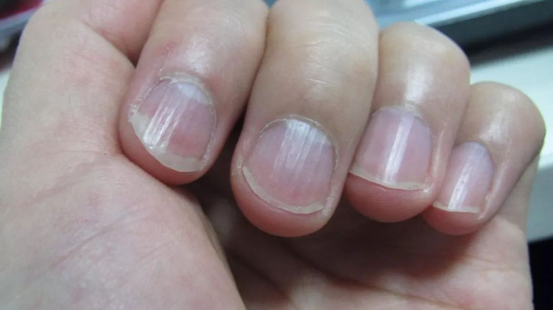 手相与健康：这种手相代表身体有病变的苗头 图片3