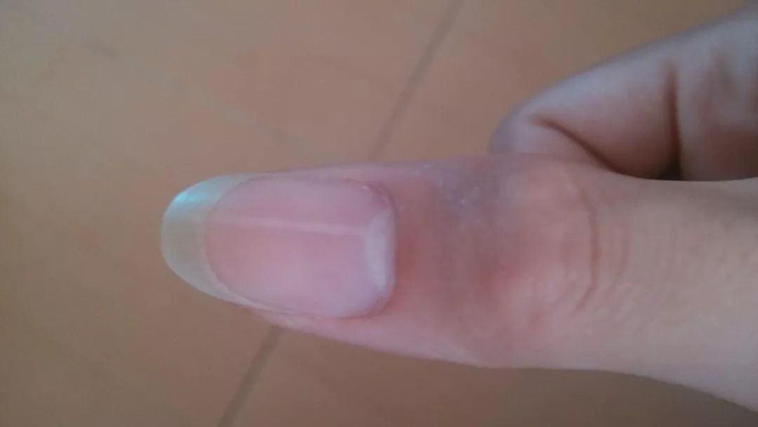 手相与健康：这种手相代表身体有病变的苗头 图片7