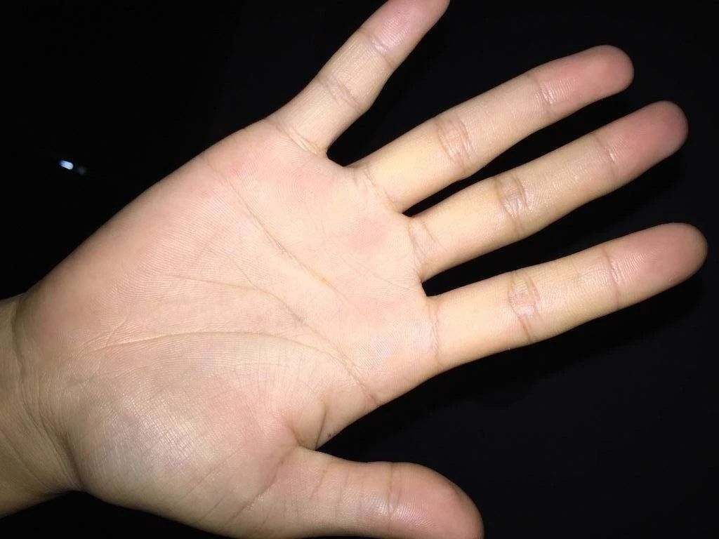 手相与健康：这种手相代表身体有病变的苗头 图片11