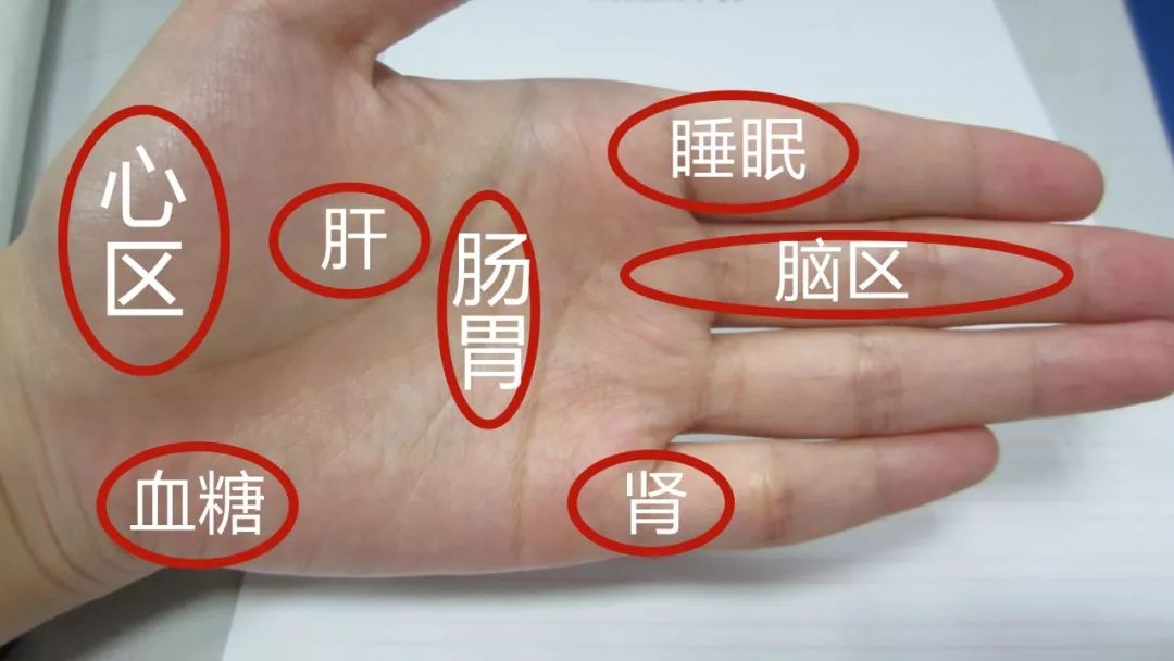 手相与健康：这种手相代表身体有病变的苗头 图片15