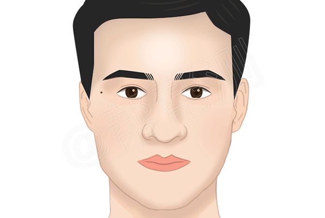 看痣识人：什么部位有痣的人财运好？ 图片1
