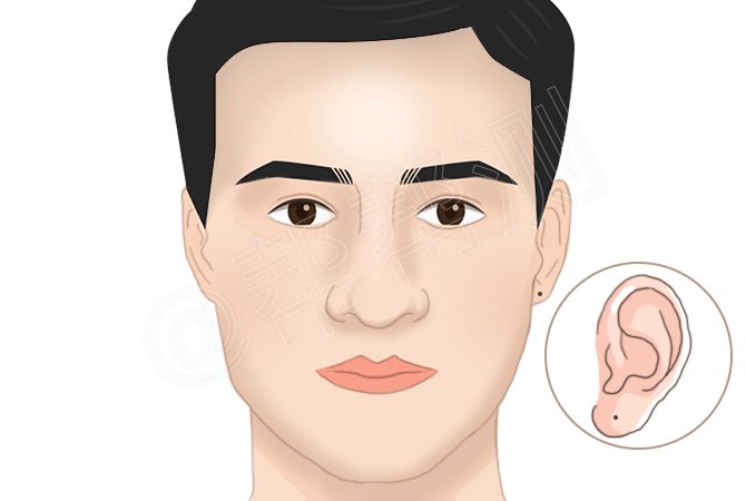 看痣识人：什么部位有痣的人财运好？ 图片15