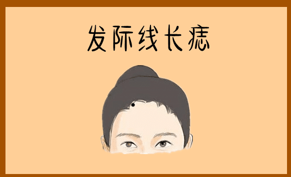 身体有这4颗辛苦痣，手里没积蓄，一辈子受穷！ 图片1